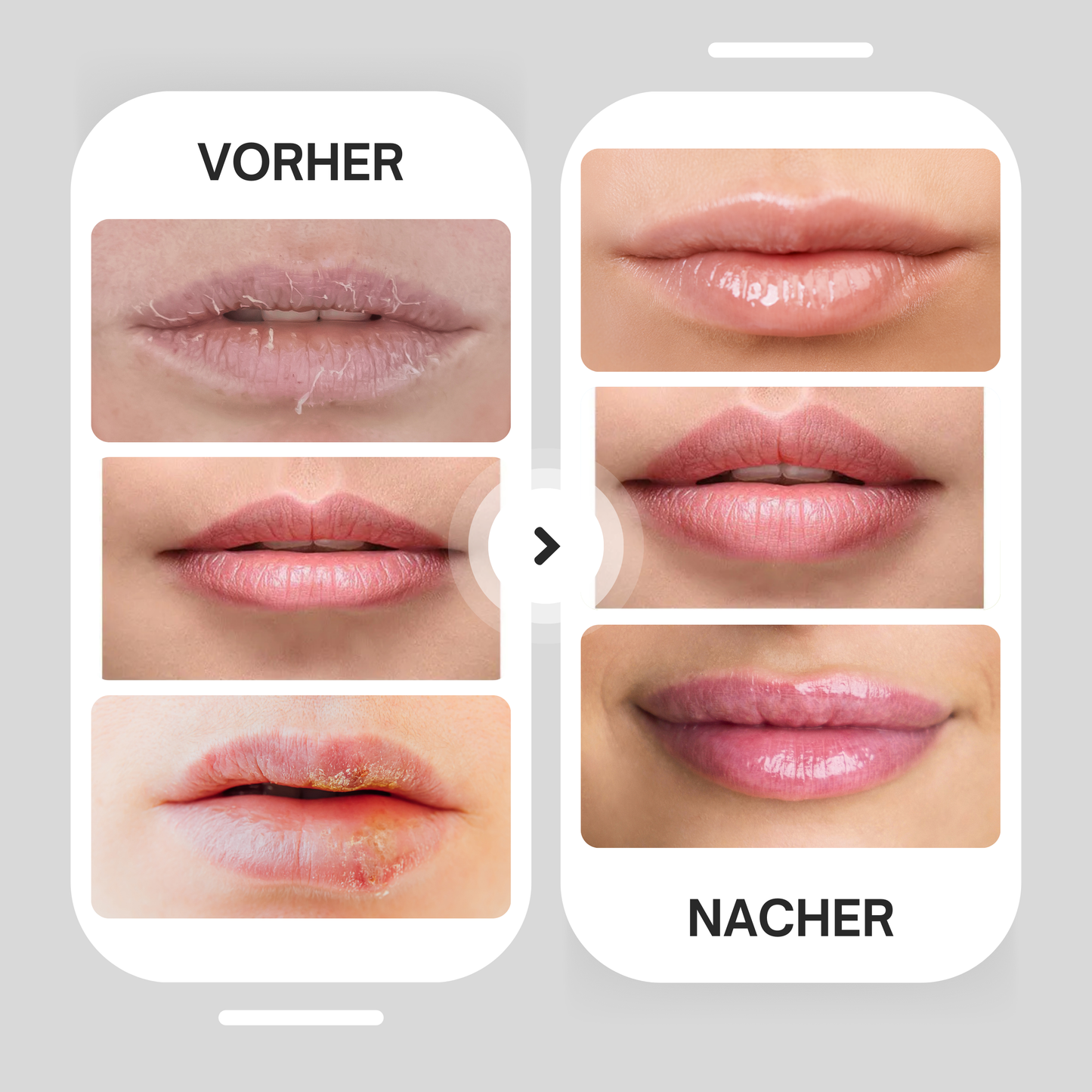 Liptastic - Lippenbooster