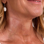 Translation missing: de.blocks.social_proof.profile_alt