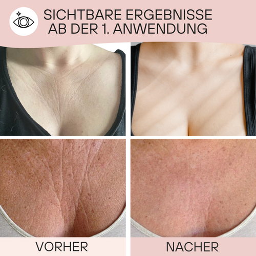 Silkana Dekolleté Patch